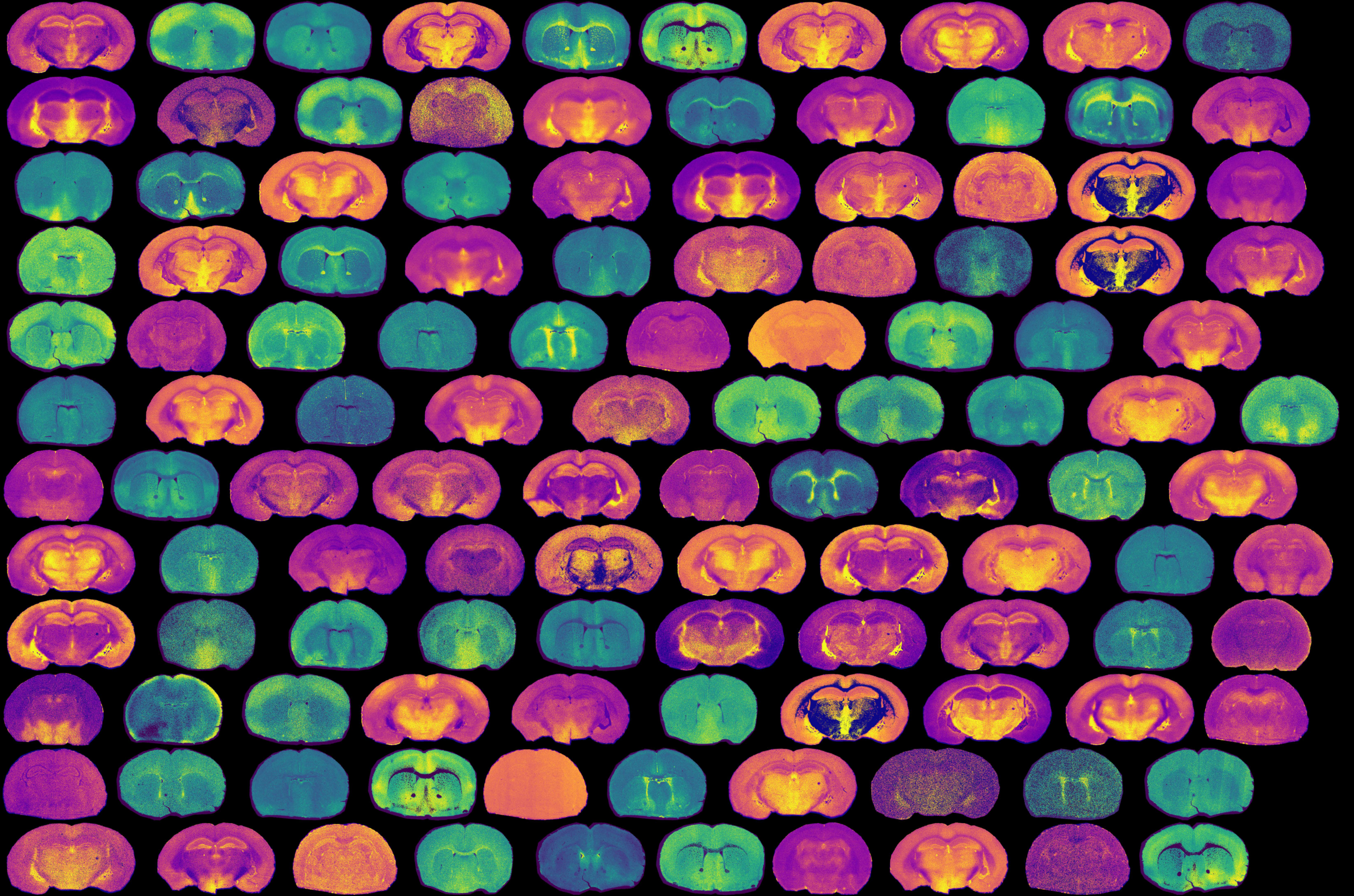 spatial metabolomics