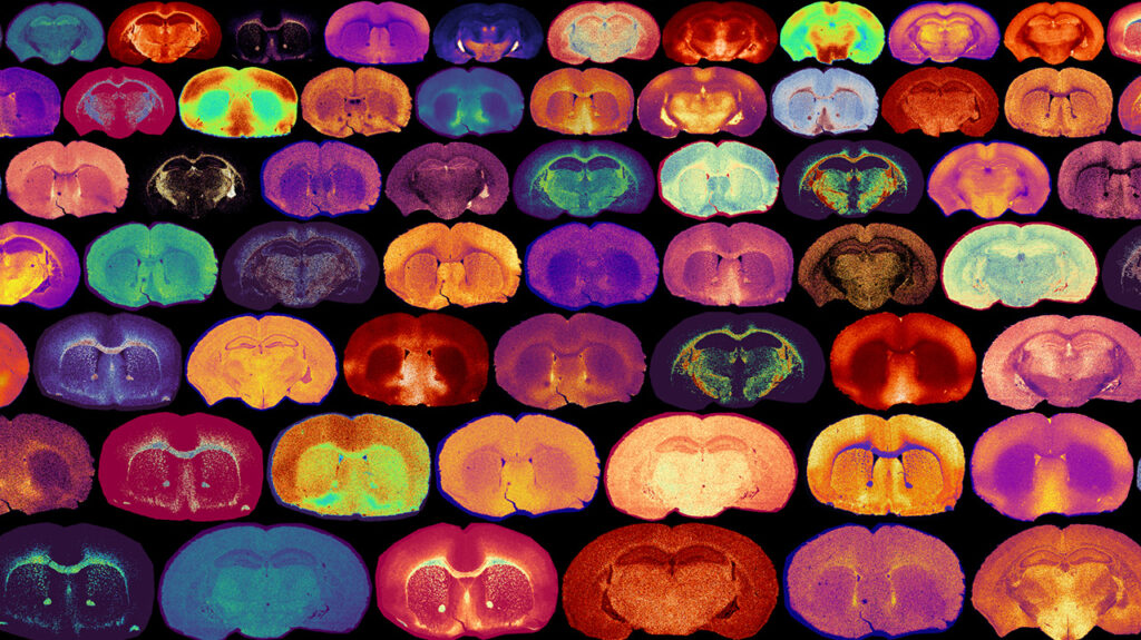 A grid of vibrant, colored microscopic images of brain tissue sections, showcasing various patterns and textures.